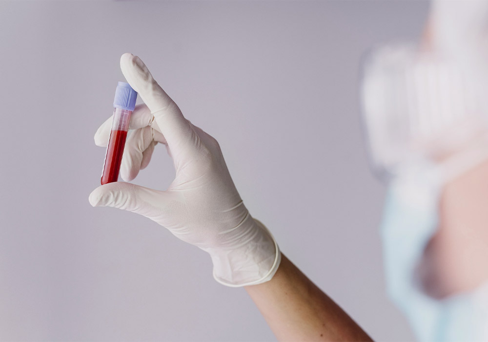 servicio analiticas rápidas farmacia ortopedia cervelló